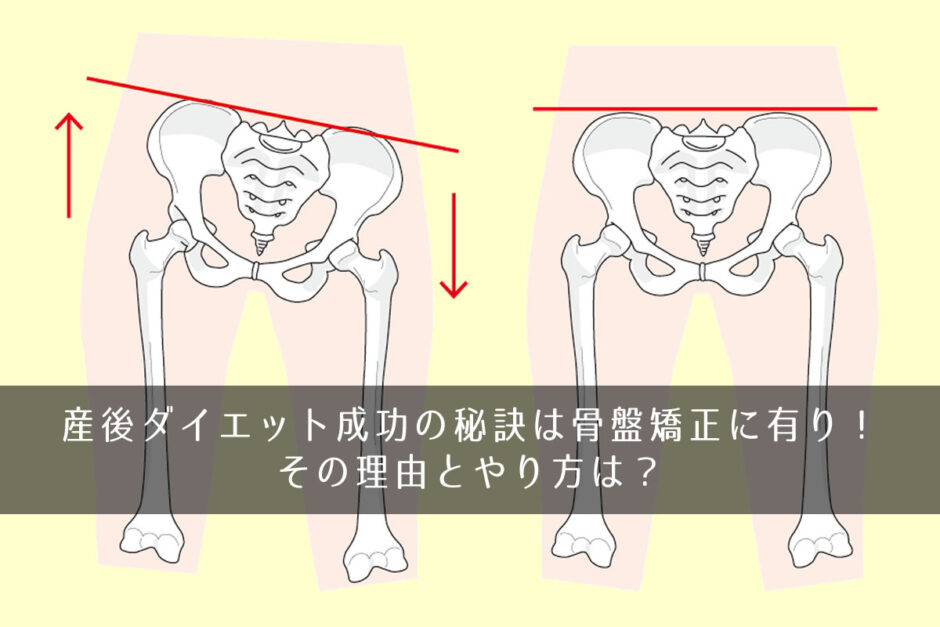 産後ダイエット成功の秘訣は骨盤矯正に有り！その理由とやり方は？