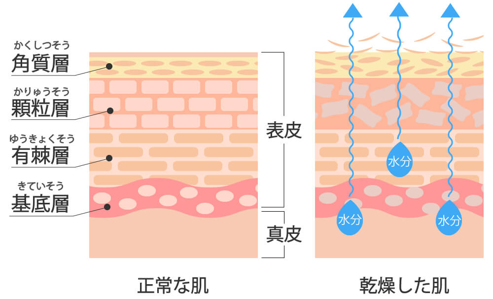 ターンオーバー