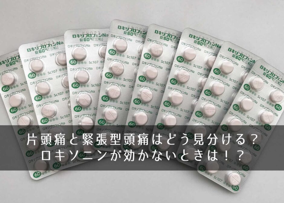 片頭痛と緊張型頭痛はどう見分ける？ロキソニンが効かないときは！？